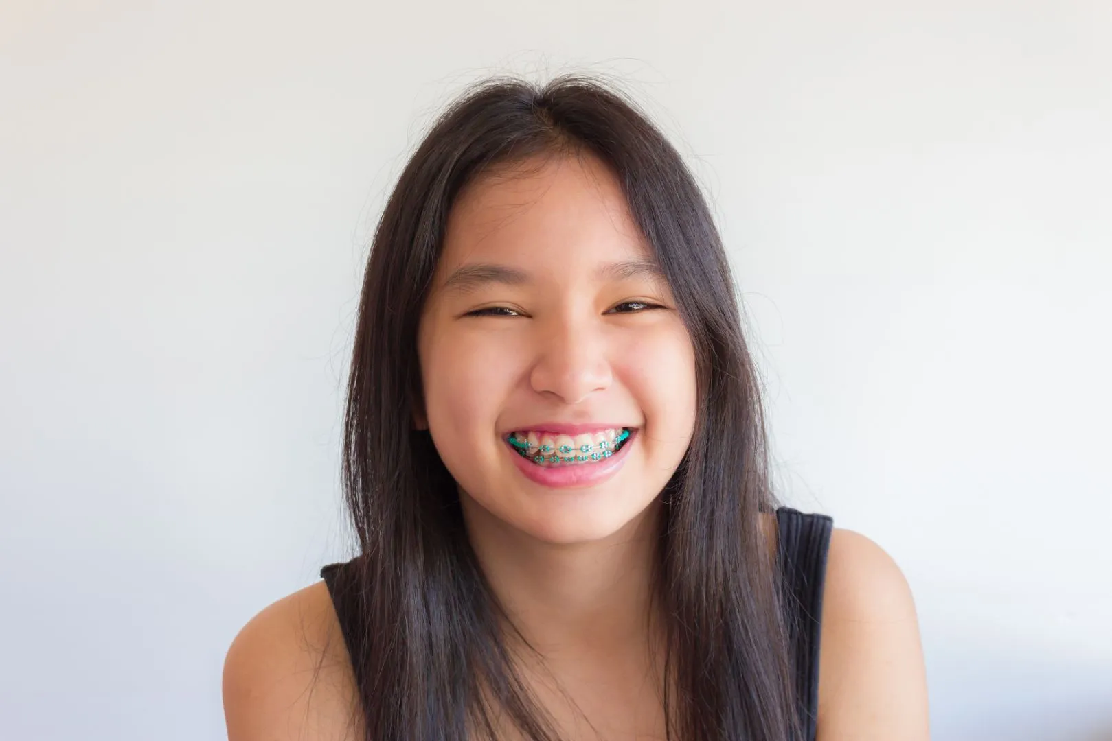 early orthodontic treatment